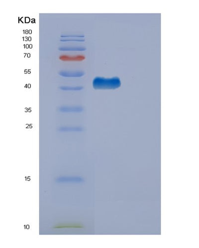 SDS-PAGE analysis of Human EDA2R (Tumor Necrosis Factor Receptor Superfamily Member 27) - Recombinant Protein, CAT# BLT-00926P, showing >90% purity under 15% SDS-PAGE (Reduced)Human EDA2R (Tumor Necrosis Factor Receptor Superfamily Member 27) - Recombinant Protein