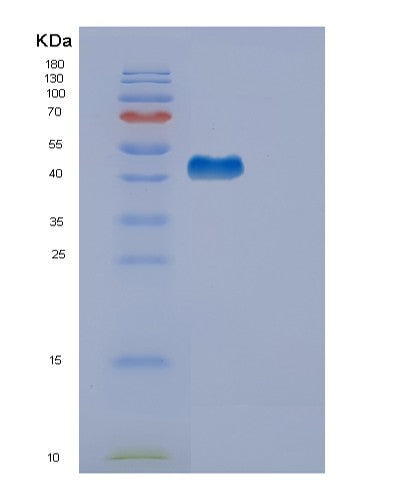 SDS-PAGE analysis of Human EDA2R (Tumor Necrosis Factor Receptor Superfamily Member 27) - Recombinant Protein, CATHuman EDA2R (Tumor Necrosis Factor Receptor Superfamily Member 27) - Recombinant Protein