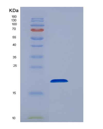SDS-PAGE analysis of Human EEF1E1 (Eukaryotic Translation Elongation Factor 1 Epsilon-1) - Recombinant Protein, CAT# BLT-00935P, showing >90% purity under 15% SDS-PAGE (Reduced)Human EEF1E1 (Eukaryotic Translation Elongation Factor 1 Epsilon-1) - Recombinant Protein