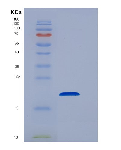 SDS-PAGE analysis of Human EEF1E1 (Eukaryotic Translation Elongation Factor 1 Epsilon-1) - Recombinant Protein, CATHuman EEF1E1 (Eukaryotic Translation Elongation Factor 1 Epsilon-1) - Recombinant Protein