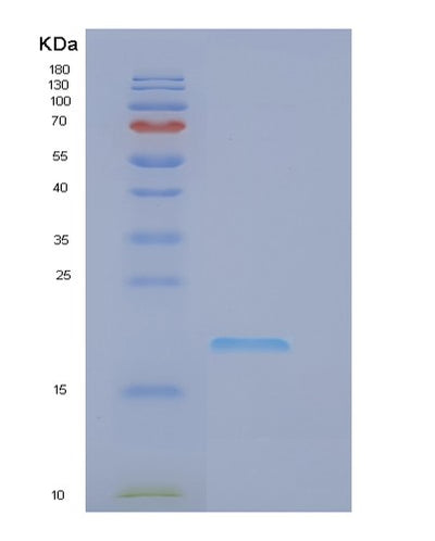 SDS-PAGE analysis of Human EIF1AY (Eukaryotic Translation Initiation Factor 1A, Y-Chromosomal) - Recombinant Protein, CAT# BLT-00952P, showing >90% purity under 15% SDS-PAGE (Reduced)Human EIF1AY (Eukaryotic Translation Initiation Factor 1A, Y-Chromosomal) - Recombinant Protein