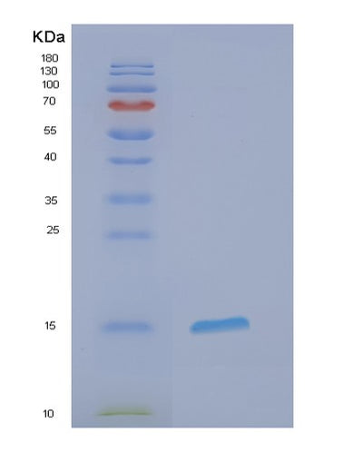 SDS-PAGE analysis of Human EIF1B (Eukaryotic Translation Initiation Factor 1B) - Recombinant Protein, CAT# BLT-00953P, showing >85% purity under 15% SDS-PAGE (Reduced)Human EIF1B (Eukaryotic Translation Initiation Factor 1B) - Recombinant Protein