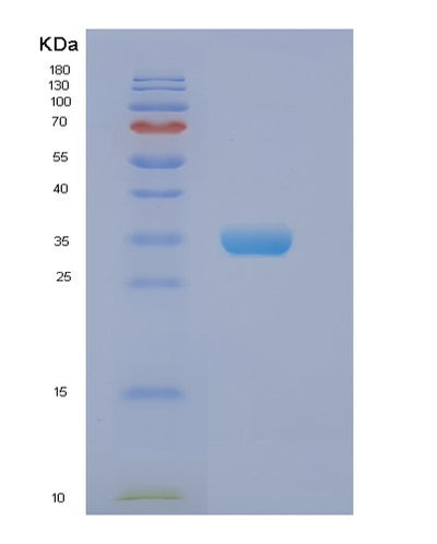 SDS-PAGE analysis of Human EIF2B1 (Translation Initiation Factor Eif2B Subunit Alpha) - Recombinant Protein, CAT# BLT-00954P, showing >95% purity under 15% SDS-PAGE (Reduced)Human EIF2B1 (Translation Initiation Factor Eif2B Subunit Alpha) - Recombinant Protein