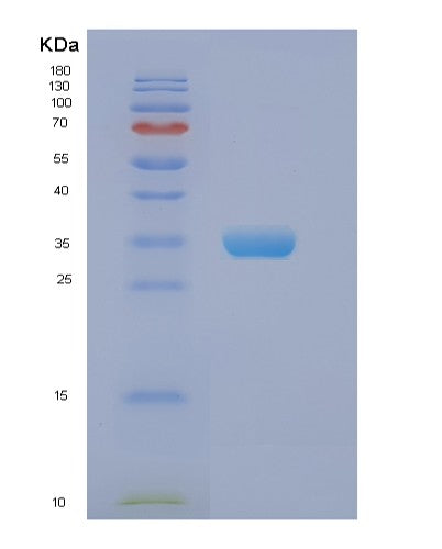 SDS-PAGE analysis of Human EIF2B1 (Translation Initiation Factor Eif2B Subunit Alpha) - Recombinant Protein, CATHuman EIF2B1 (Translation Initiation Factor Eif2B Subunit Alpha) - Recombinant Protein