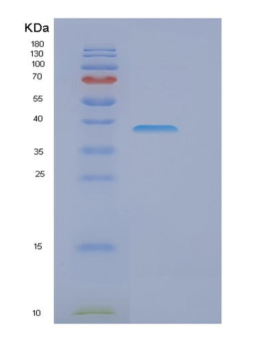 SDS-PAGE analysis of Human EIF3I (Eukaryotic Translation Initiation Factor 3 Subunit I) - Recombinant Protein, CAT# BLT-00957P, showing >95% purity under 15% SDS-PAGE (Reduced)Human EIF3I (Eukaryotic Translation Initiation Factor 3 Subunit I) - Recombinant Protein