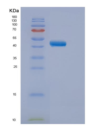 SDS-PAGE analysis of Human ELP4 (Elongator Complex Protein 4) - Recombinant Protein, CAT# BLT-00972P, showing >95% purity under 15% SDS-PAGE (Reduced)Human ELP4 (Elongator Complex Protein 4) - Recombinant Protein