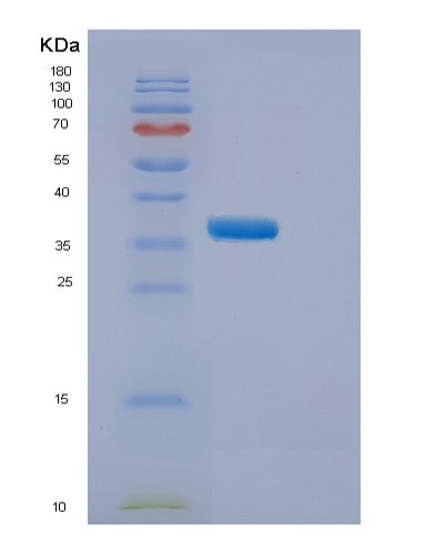 SDS-PAGE analysis of Human ELP5 (Elongator Complex Protein 5) - Recombinant Protein, CATHuman ELP5 (Elongator Complex Protein 5) - Recombinant Protein