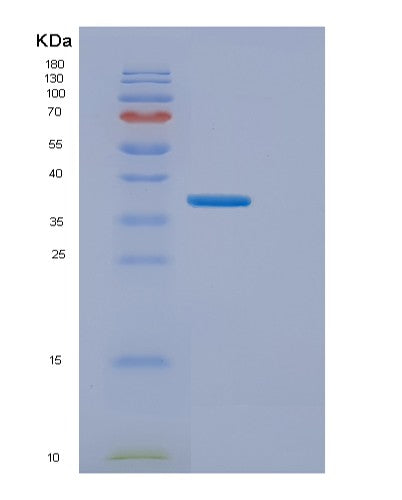 SDS-PAGE analysis of Human EMC2 (Er Membrane Protein Complex Subunit 2) - Recombinant Protein, CATHuman EMC2 (Er Membrane Protein Complex Subunit 2) - Recombinant Protein