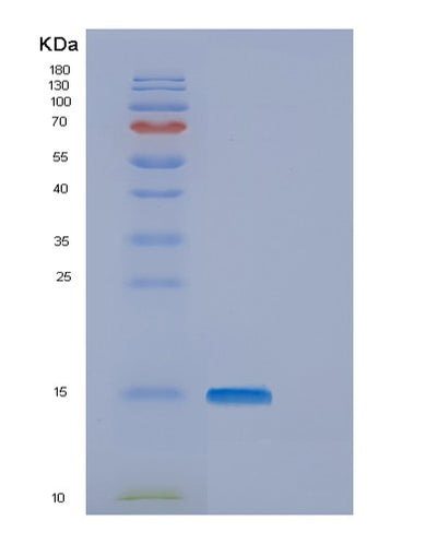 SDS-PAGE analysis of Human ENSA (Alpha-Endosulfine) - Recombinant Protein, CAT# BLT-00983P, showing >85% purity under 15% SDS-PAGE (Reduced)Human ENSA (Alpha-Endosulfine) - Recombinant Protein