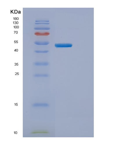 SDS-PAGE analysis of Human ENTPD3 (Ectonucleoside Triphosphate Diphosphohydrolase 3) - Recombinant Protein, CAT# BLT-00984P, showing >95% purity under 15% SDS-PAGE (Reduced)Human ENTPD3 (Ectonucleoside Triphosphate Diphosphohydrolase 3) - Recombinant Protein