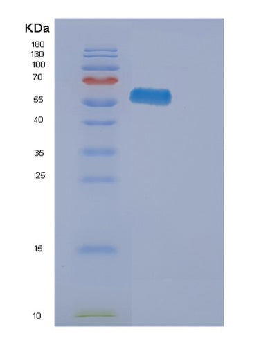 SDS-PAGE analysis of Human EPHA2 (Ephrin Type-A Receptor 2) - Recombinant Protein, CAT# BLT-00991P, showing >90% purity under 15% SDS-PAGE (Reduced)Human EPHA2 (Ephrin Type-A Receptor 2) - Recombinant Protein