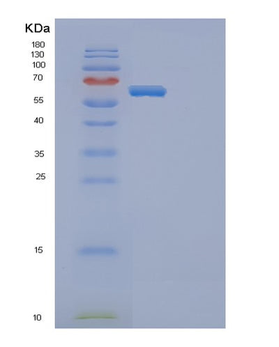 SDS-PAGE analysis of Mouse Ephb4 (Ephrin Type-B Receptor 4) - Recombinant Protein, CAT# BLT-00994P, showing >90% purity under 15% SDS-PAGE (Reduced)Mouse Ephb4 (Ephrin Type-B Receptor 4) - Recombinant Protein