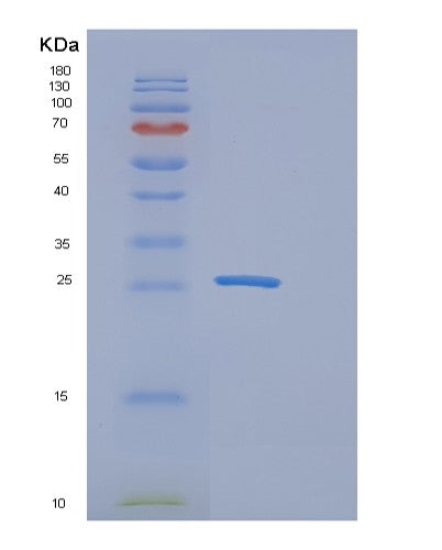 SDS-PAGE analysis of Human EPOR (Erythropoietin Receptor) - Recombinant Protein, CATHuman EPOR (Erythropoietin Receptor) - Recombinant Protein