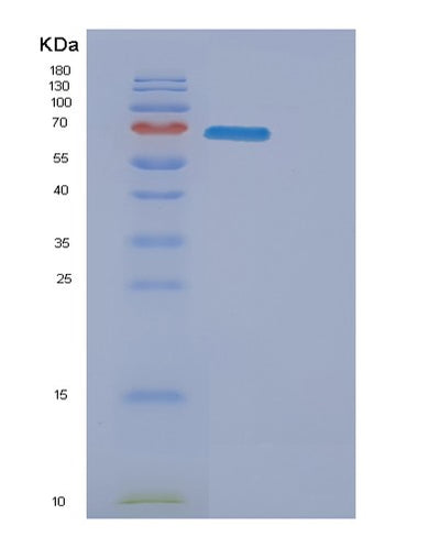 SDS-PAGE analysis of Mouse Erbb3 (Receptor Tyrosine-Protein Kinase Erbb-3) - Recombinant Protein, CAT# BLT-01001P, showing >85% purity under 15% SDS-PAGE (Reduced)Mouse Erbb3 (Receptor Tyrosine-Protein Kinase Erbb-3) - Recombinant Protein