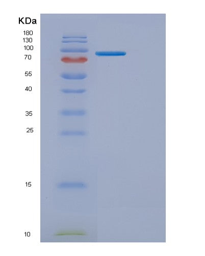SDS-PAGE analysis of Human ERBB3 (Receptor Tyrosine-Protein Kinase Erbb-3) - Recombinant Protein, CATHuman ERBB3 (Receptor Tyrosine-Protein Kinase Erbb-3) - Recombinant Protein