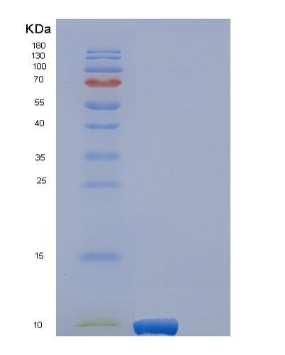 SDS-PAGE analysis of Human EREG (Proepiregulin) - Recombinant Protein, CATHuman EREG (Proepiregulin) - Recombinant Protein