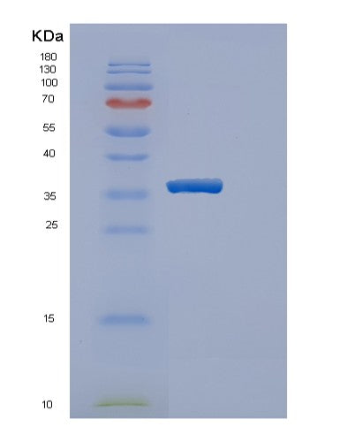 SDS-PAGE analysis of Human ERGIC2 (Endoplasmic Reticulum-Golgi Intermediate Compartment Protein 2) - Recombinant Protein, CATHuman ERGIC2 (Endoplasmic Reticulum-Golgi Intermediate Compartment Protein 2) - Recombinant Protein