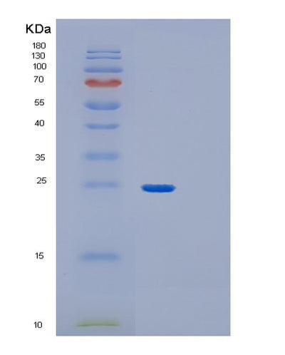 SDS-PAGE analysis of Human GPX1 (Glutathione Peroxidase 1) - Recombinant Protein, CAT# BLT-01269P, showing >85% purity under 15% SDS-PAGE (Reduced)Human GPX1 (Glutathione Peroxidase 1) - Recombinant Protein