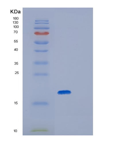 SDS-PAGE analysis of Human GPX7 (Glutathione Peroxidase 7) - Recombinant Protein, CAT# BLT-01272P, showing >85% purity under 15% SDS-PAGE (Reduced)Human GPX7 (Glutathione Peroxidase 7) - Recombinant Protein