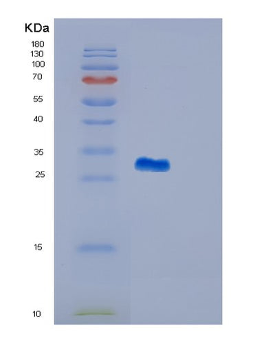 SDS-PAGE analysis of Human GSTM4 (Glutathione S-Transferase Mu 4) - Recombinant Protein, CAT# BLT-01291P, showing >85% purity under 15% SDS-PAGE (Reduced)Human GSTM4 (Glutathione S-Transferase Mu 4) - Recombinant Protein