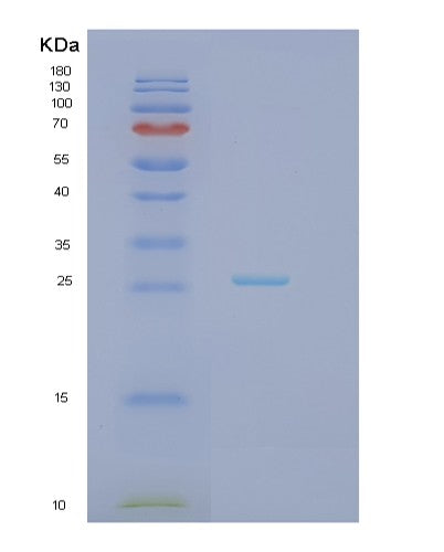 SDS-PAGE analysis of Human HAND1 (Heart- And Neural Crest Derivatives-Expressed Protein 1) - Recombinant Protein, CATHuman HAND1 (Heart- And Neural Crest Derivatives-Expressed Protein 1) - Recombinant Protein