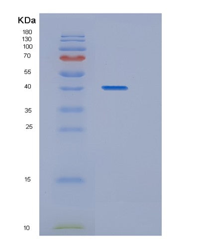 SDS-PAGE analysis of Human HAT1 (Histone Acetyltransferase Type B Catalytic Subunit) - Recombinant Protein, CATHuman HAT1 (Histone Acetyltransferase Type B Catalytic Subunit) - Recombinant Protein