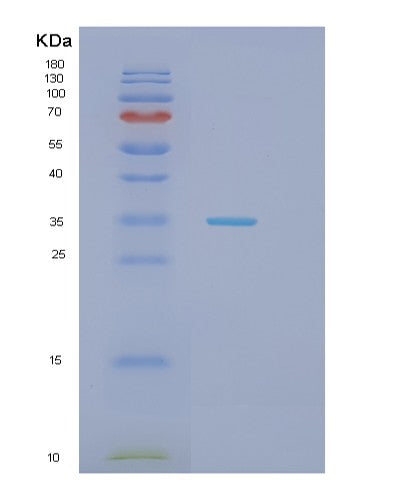 SDS-PAGE analysis of Human HAUS1 (Haus Augmin-Like Complex Subunit 1) - Recombinant Protein, CATHuman HAUS1 (Haus Augmin-Like Complex Subunit 1) - Recombinant Protein