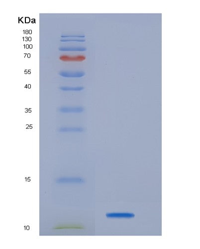 SDS-PAGE analysis of Human HBEGF (Proheparin-Binding Egf-Like Growth Factor) - Recombinant Protein, CATHuman HBEGF (Proheparin-Binding Egf-Like Growth Factor) - Recombinant Protein