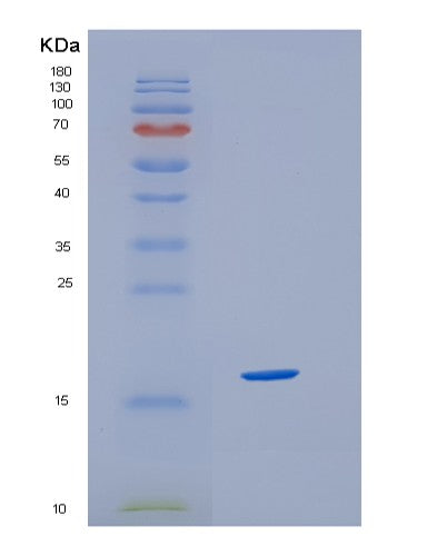 SDS-PAGE analysis of Human HBQ1 (Hemoglobin Subunit Theta-1) - Recombinant Protein, CATHuman HBQ1 (Hemoglobin Subunit Theta-1) - Recombinant Protein