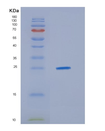 SDS-PAGE analysis of Human HDGFL3 (Hepatoma-Derived Growth Factor-Related Protein 3) - Recombinant Protein, CATHuman HDGFL3 (Hepatoma-Derived Growth Factor-Related Protein 3) - Recombinant Protein
