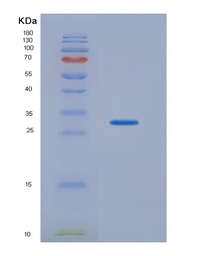 SDS-PAGE analysis of Human HDHD2 (Haloacid Dehalogenase-Like Hydrolase Domain-Containing Protein 2) - Recombinant Protein, CATHuman HDHD2 (Haloacid Dehalogenase-Like Hydrolase Domain-Containing Protein 2) - Recombinant Protein
