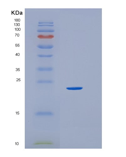 SDS-PAGE analysis of Human HEBP1 (Heme-Binding Protein 1) - Recombinant Protein, CATHuman HEBP1 (Heme-Binding Protein 1) - Recombinant Protein