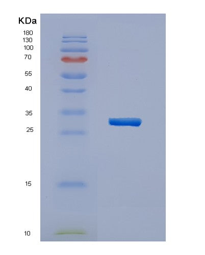 SDS-PAGE analysis of Human HERPUD1 (Homocysteine-Responsive Endoplasmic Reticulum-Resident Ubiquitin-Like Domain Member 1 Protein) - Recombinant Protein, CATHuman HERPUD1 (Homocysteine-Responsive Endoplasmic Reticulum-Resident Ubiquitin-Like Domain Member 1 Protein) - Recombinant Protein