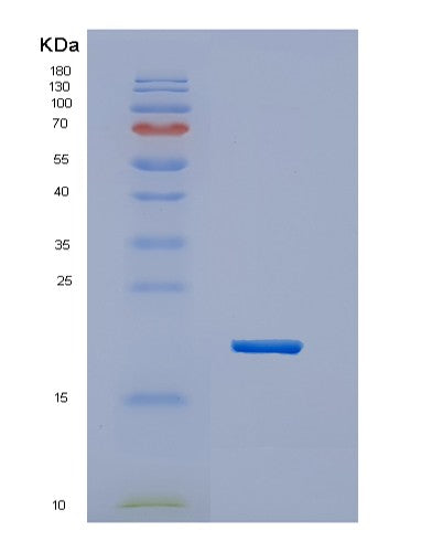 SDS-PAGE analysis of Human HES2 (Transcription Factor Hes-2) - Recombinant Protein, CATHuman HES2 (Transcription Factor Hes-2) - Recombinant Protein