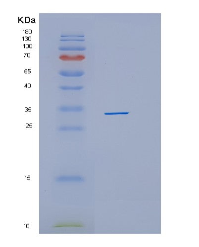 SDS-PAGE analysis of Human HHEX (Hematopoietically-Expressed Homeobox Protein Hhex) - Recombinant Protein, CATHuman HHEX (Hematopoietically-Expressed Homeobox Protein Hhex) - Recombinant Protein