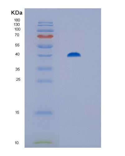 SDS-PAGE analysis of Human ST13 (Hsc70-Interacting Protein) - Recombinant Protein, CATHuman ST13 (Hsc70-Interacting Protein) - Recombinant Protein