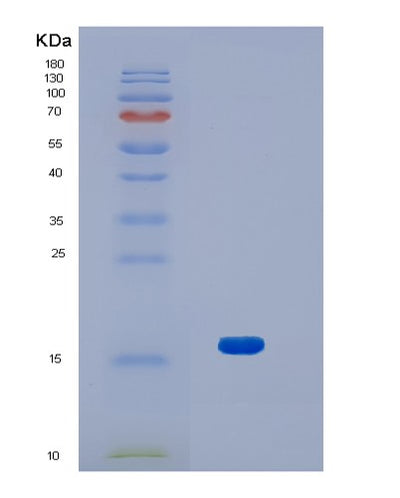 SDS-PAGE analysis of Human JPT2 (Jupiter Microtubule Associated Homolog 2) - Recombinant Protein, CAT# BLT-01393P, showing >85% purity under 15% SDS-PAGE (Reduced)Human JPT2 (Jupiter Microtubule Associated Homolog 2) - Recombinant Protein