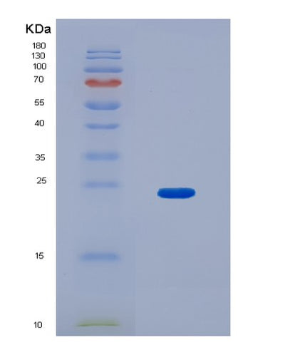 SDS-PAGE analysis of Human JPT1 (Jupiter Microtubule Associated Homolog 1) - Recombinant Protein, CAT# BLT-01394P, showing >95% purity under 15% SDS-PAGE (Reduced)Human JPT1 (Jupiter Microtubule Associated Homolog 1) - Recombinant Protein