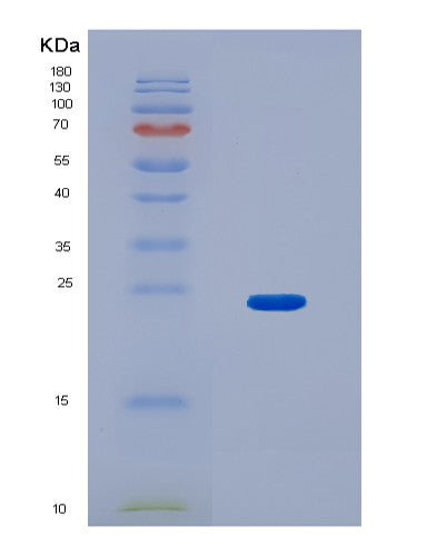 SDS-PAGE analysis of Human JPT1 (Jupiter Microtubule Associated Homolog 1) - Recombinant Protein, CATHuman JPT1 (Jupiter Microtubule Associated Homolog 1) - Recombinant Protein