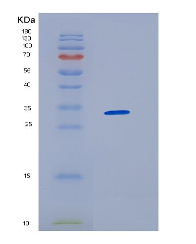 SDS-PAGE analysis of Human HNRNPAB (Heterogeneous Nuclear Ribonucleoprotein A/B) - Recombinant Protein, CATHuman HNRNPAB (Heterogeneous Nuclear Ribonucleoprotein A/B) - Recombinant Protein