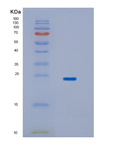 SDS-PAGE analysis of Human HPCAL1 (Hippocalcin-Like Protein 1) - Recombinant Protein, CAT# BLT-01408P, showing >85% purity under 15% SDS-PAGE (Reduced)Human HPCAL1 (Hippocalcin-Like Protein 1) - Recombinant Protein