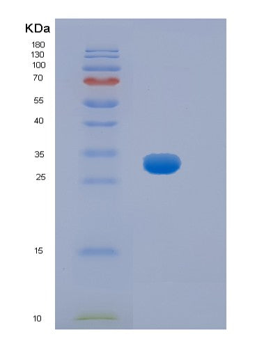 SDS-PAGE analysis of Mouse Hpgd (15-Hydroxyprostaglandin Dehydrogenase [Nad(+)]) - Recombinant Protein, CATMouse Hpgd (15-Hydroxyprostaglandin Dehydrogenase [Nad(+)]) - Recombinant Protein