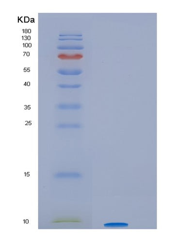 SDS-PAGE analysis of Human HSBP1 (Heat Shock Factor-Binding Protein 1) - Recombinant Protein, CAT# BLT-01422P, showing >85% purity under 15% SDS-PAGE (Reduced)Human HSBP1 (Heat Shock Factor-Binding Protein 1) - Recombinant Protein
