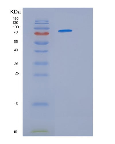 SDS-PAGE analysis of Human HSP90AA1 (Heat Shock Protein Hsp 90-Alpha) - Recombinant Protein, CAT# BLT-01442P, showing >95% purity under 15% SDS-PAGE (Reduced)Human HSP90AA1 (Heat Shock Protein Hsp 90-Alpha) - Recombinant Protein
