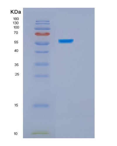 SDS-PAGE analysis of Human HSPBAP1 (Hspb1-Associated Protein 1) - Recombinant Protein, CAT# BLT-01454P, showing >95% purity under 15% SDS-PAGE (Reduced)Human HSPBAP1 (Hspb1-Associated Protein 1) - Recombinant Protein