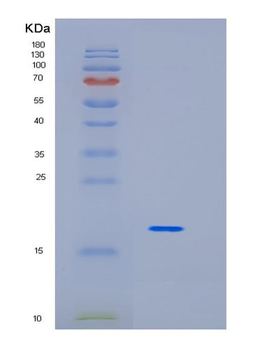 SDS-PAGE analysis of Human ID1 (Dna-Binding Protein Inhibitor Id-1) - Recombinant Protein, CAT# BLT-01466P, showing >95% purity under 15% SDS-PAGE (Reduced)Human ID1 (Dna-Binding Protein Inhibitor Id-1) - Recombinant Protein