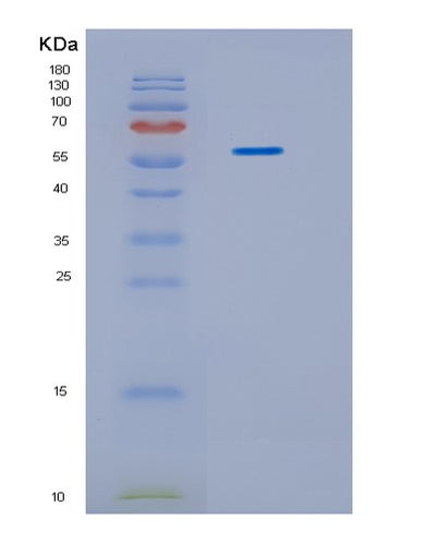 SDS-PAGE analysis of Human IDS (Iduronate 2-Sulfatase) - Recombinant Protein, CAT# BLT-01474P, showing >85% purity under 15% SDS-PAGE (Reduced)Human IDS (Iduronate 2-Sulfatase) - Recombinant Protein