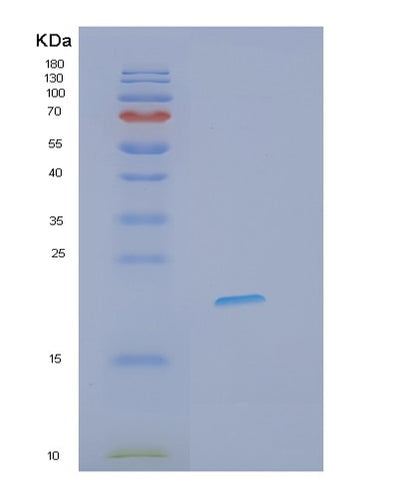 SDS-PAGE analysis of Human IFNL3 (Interferon Lambda-3) - Recombinant Protein, CAT# BLT-01487P, showing >85% purity under 15% SDS-PAGE (Reduced)Human IFNL3 (Interferon Lambda-3) - Recombinant Protein