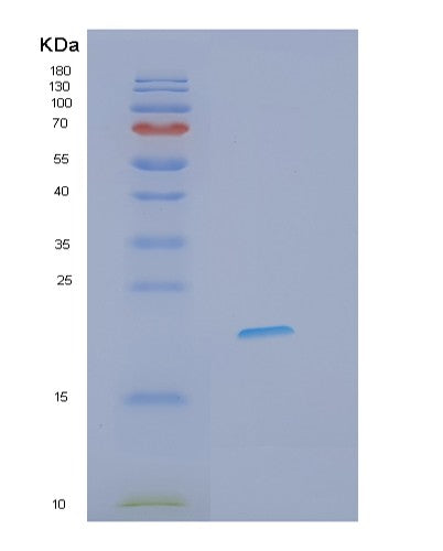 SDS-PAGE analysis of Human IFNL3 (Interferon Lambda-3) - Recombinant Protein, CATHuman IFNL3 (Interferon Lambda-3) - Recombinant Protein