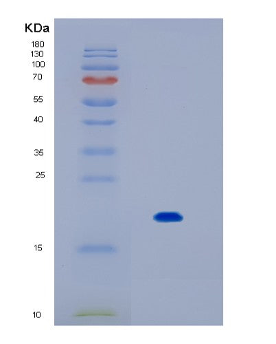 SDS-PAGE analysis of Human IL17B (Interleukin-17B) - Recombinant Protein, CATHuman IL17B (Interleukin-17B) - Recombinant Protein